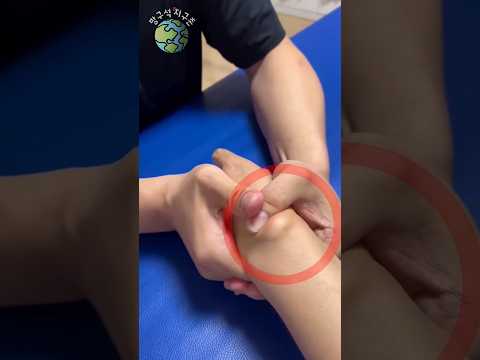 믿기 힘든 혹 제거법 thumbnail