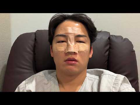 홧김에 성형수술함.. thumbnail