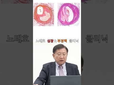 노태호의심장이야기 thumbnail