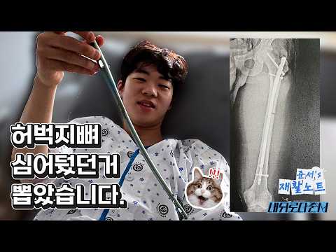 허벅지뼈 안에 있던 것의 정체  l 재활노트 Ep.01 thumbnail