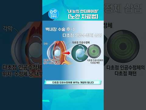 안경, 썼다 벗었다 하시나요? thumbnail